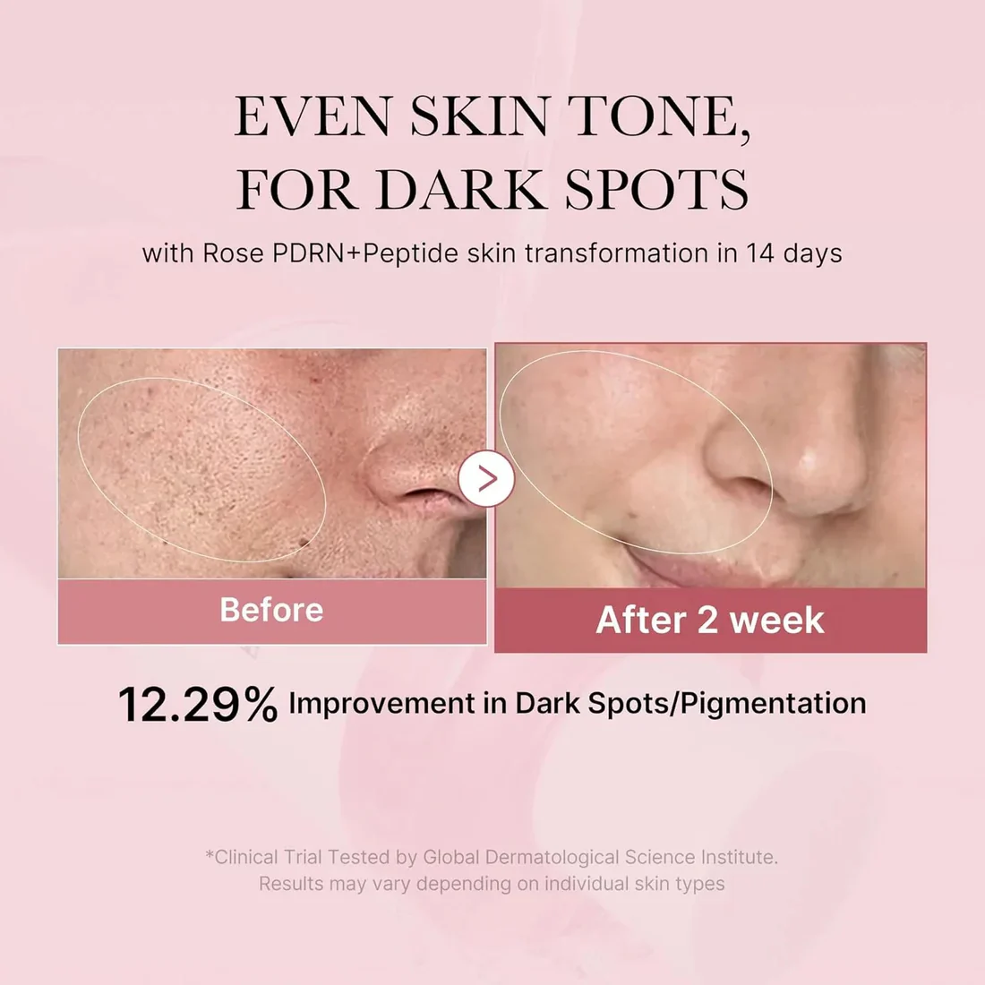 medicube - PDRN Pink Niacinamide Milky Toner