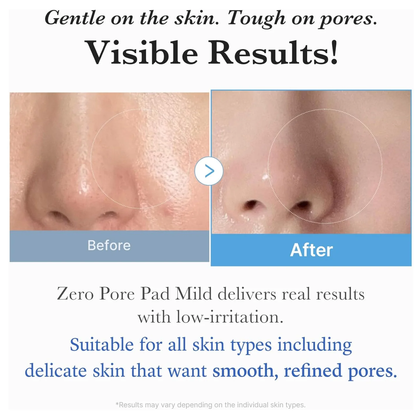medicube - Zero Pore Pad Mild