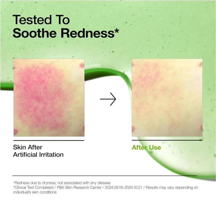 Anua - Azelaic Acid 10 Hyaluron Redness Soothing Serum